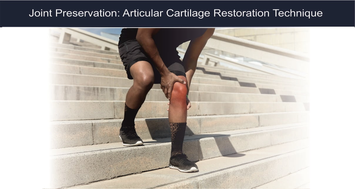 You are currently viewing Joint Preservation: Articular Cartilage Restoration Technique