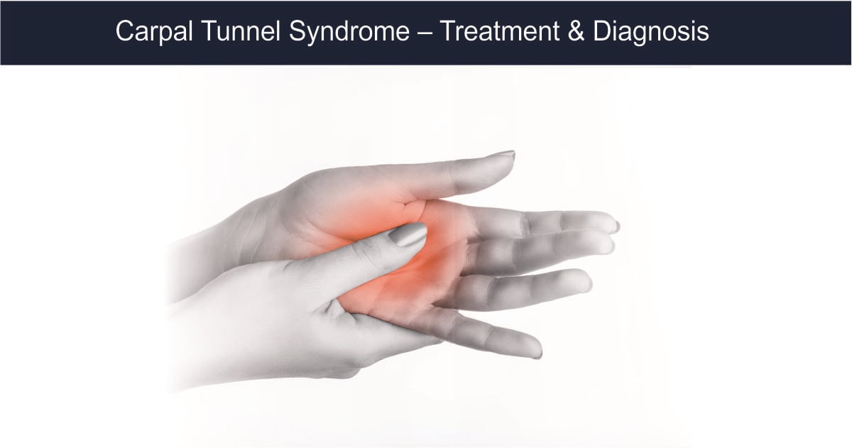 You are currently viewing Carpal Tunnel Syndrome – Treatment and Diagnosis