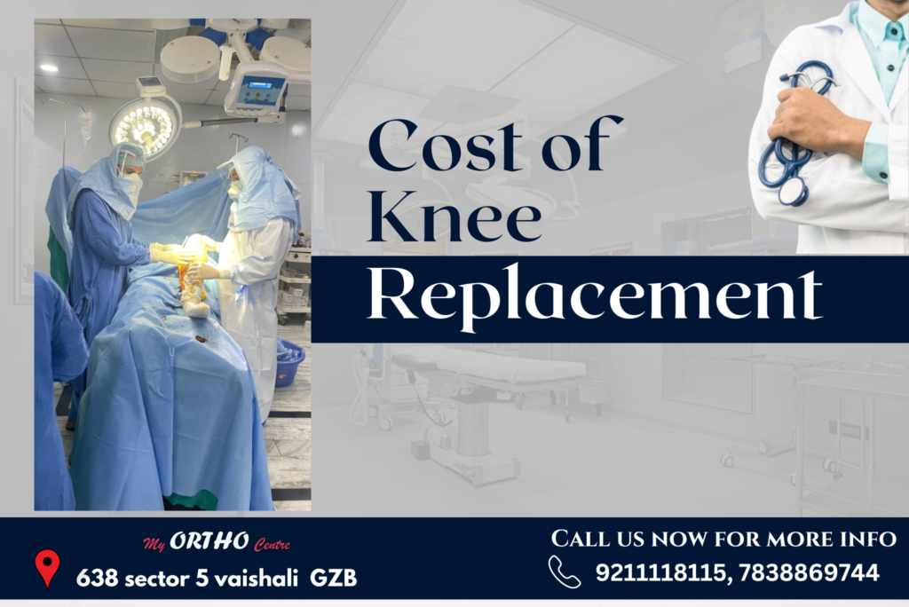 Knee Replacement Cost in India