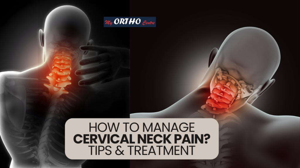 How to Manage Cervical Neck Pain: Tips and Treatment Options