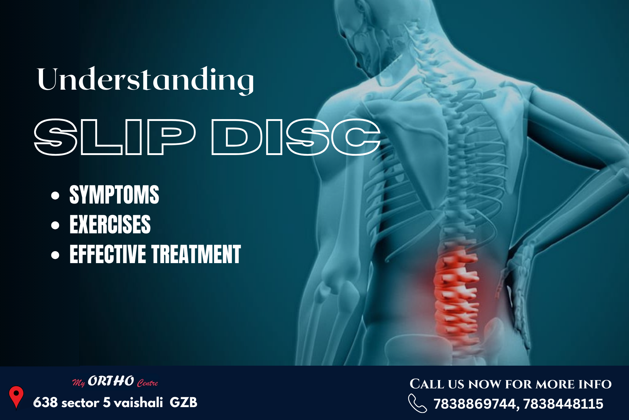 You are currently viewing Understanding Slip Disc: Symptoms, Exercises, and Effective Treatment Options