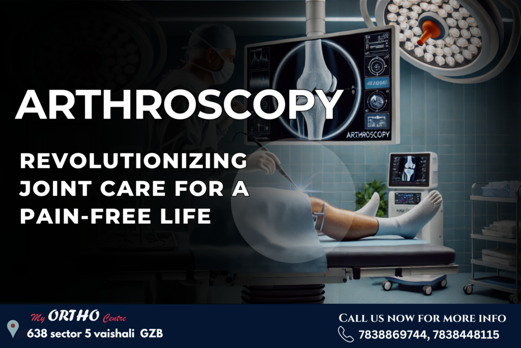 Arthroscopy: Revolutionizing Joint Care for a Pain-Free Life